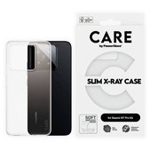 Maska X-Ray za Xiaomi 15T Pro 5G, transparent, CARE